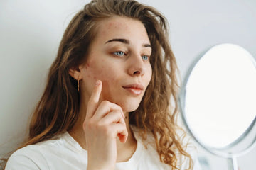 June is Acne Awareness Month: Here’s How We Can Help