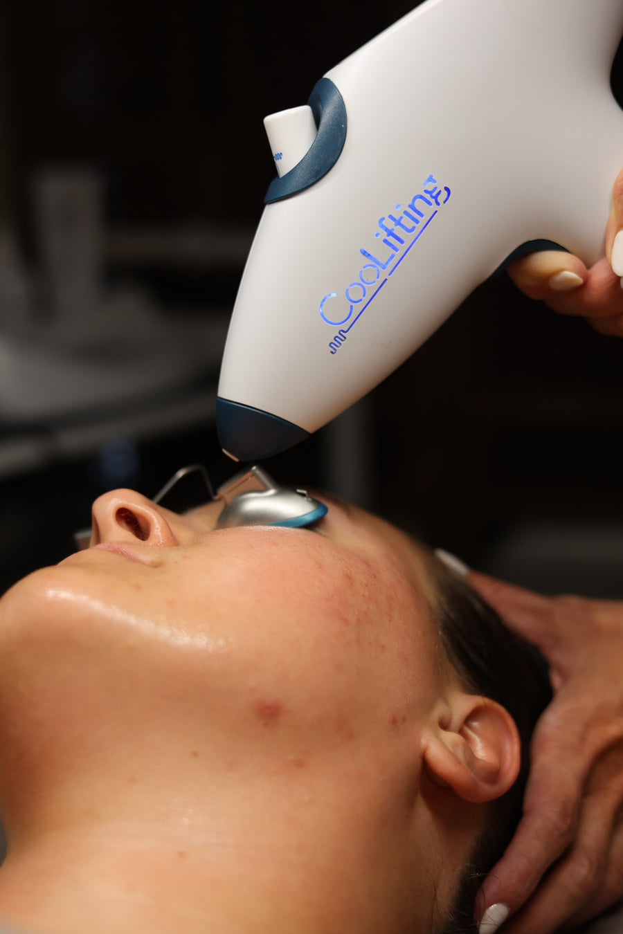 Microneedling