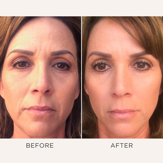 Osmosis Beauty Recovery — clinical results