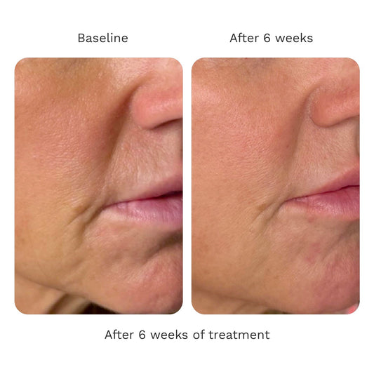 Adipeau Volume Cream — product detail 1