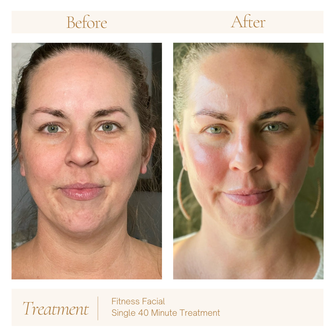 Fitness Facial — before